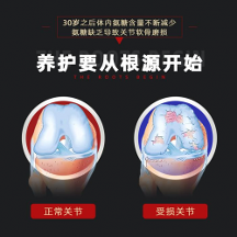 軟骨硬骨一起補(bǔ),哈藥蓋中蓋氨糖更適合國人的補(bǔ)鈣選擇