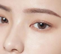 廈門激光祛斑會反彈嗎？美萊做一次要多少錢？