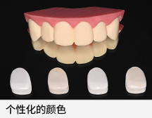 極薄強(qiáng)韌氧化鋯貼面技術(shù)，一款免磨牙貼面技術(shù)
